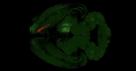 Psilocybin Persistently Restores Specific Cortical Networks of Mice | Broadcaste...