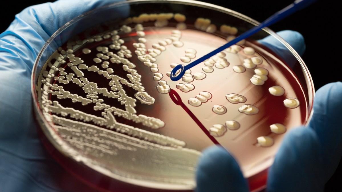 Intensive materials after superbug infection